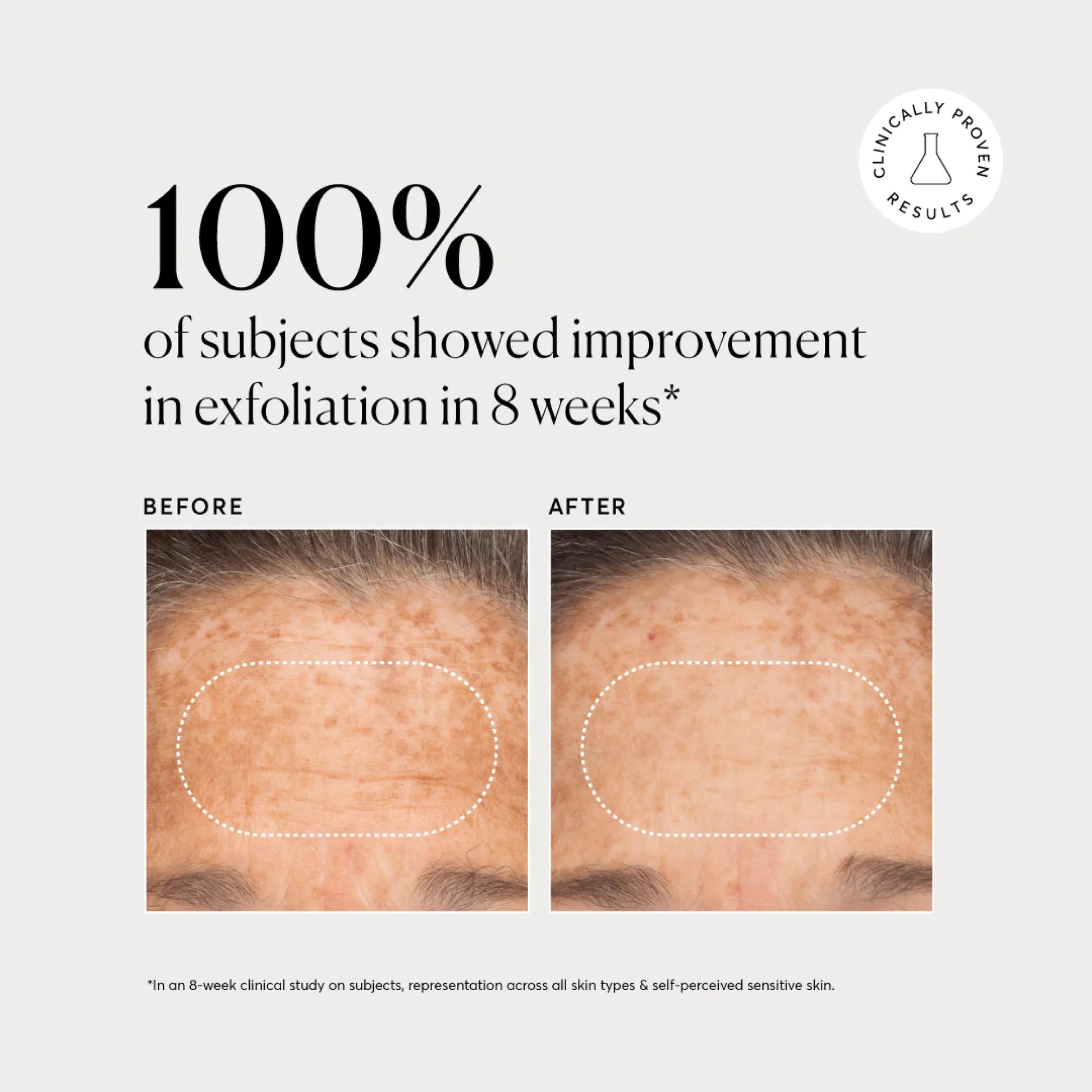 bha-liquid-exfoliant-2-o1 NATR-10027-Alt-Images-BHA-Liquid-Exfoliant-2_-03.webp